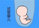 培养青岛捐卵宝宝艺术细胞的小技巧